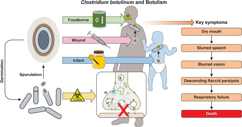 肉毒中毒的微观战场：电子显微镜下的致命毒素