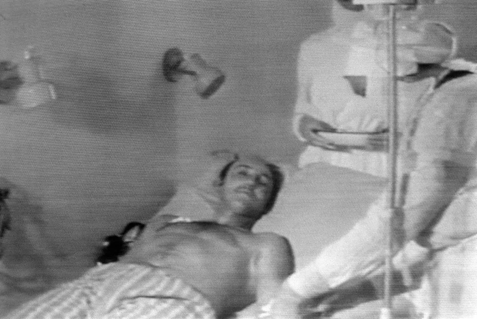 苏联电视台照片显示一名在切尔诺贝利爆炸中受伤的男子正在接受医疗救治。