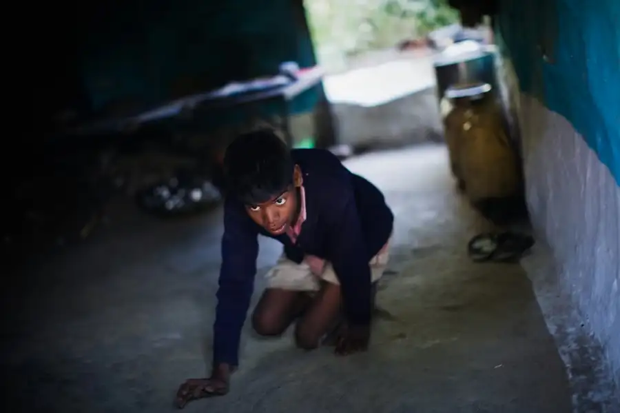 出生时有腿部缺陷的15岁少年萨钦·库马尔在家中爬行,2009年