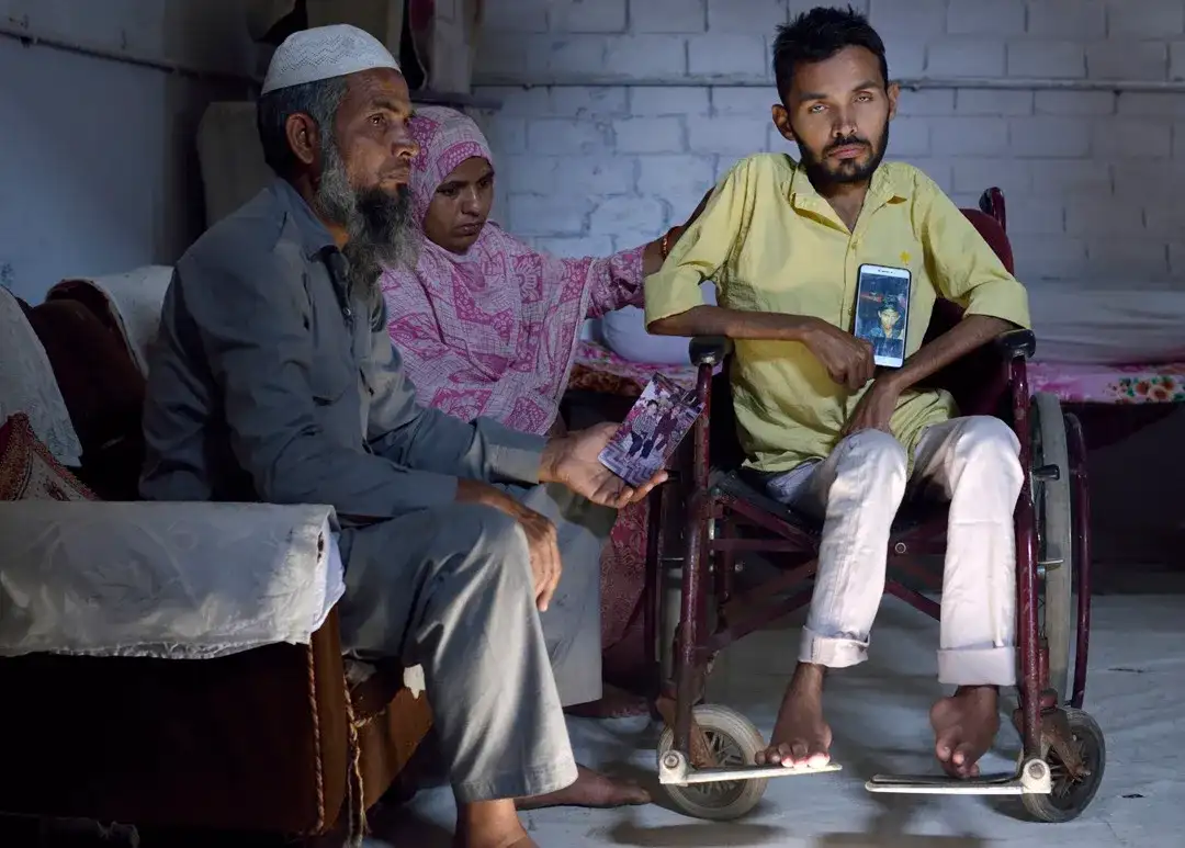 博帕尔第二代受害者,他们患有多种先天性疾病