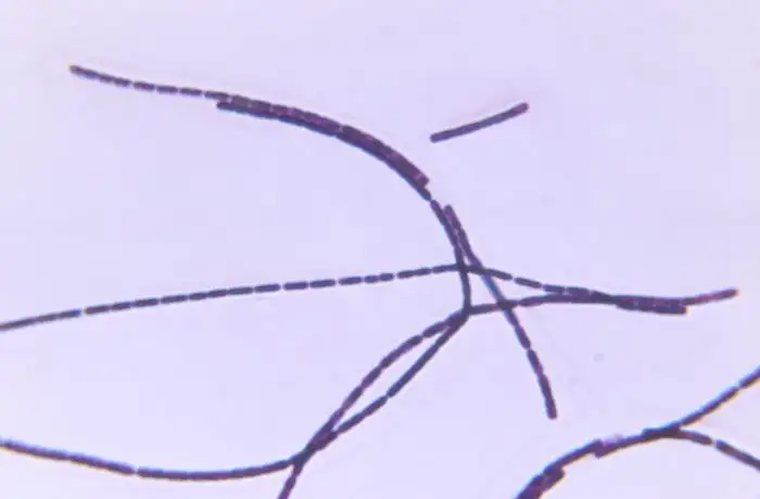 炭疽杆菌显微镜图像