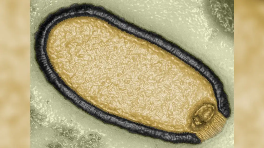 电子显微镜下的阔口罐病毒（Pithovirus sibericum），这种从三万年冻土中复活的巨型病毒挑战着人类对生命极限的认知