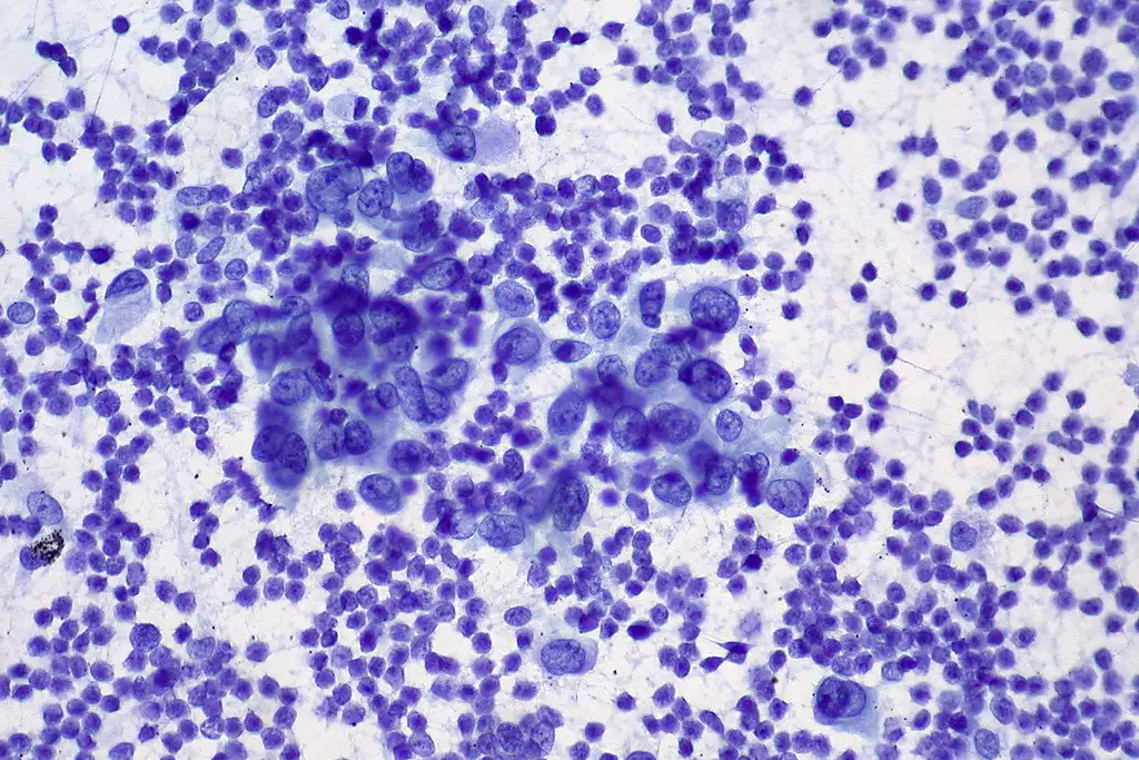 肝脏活检的组织学图像