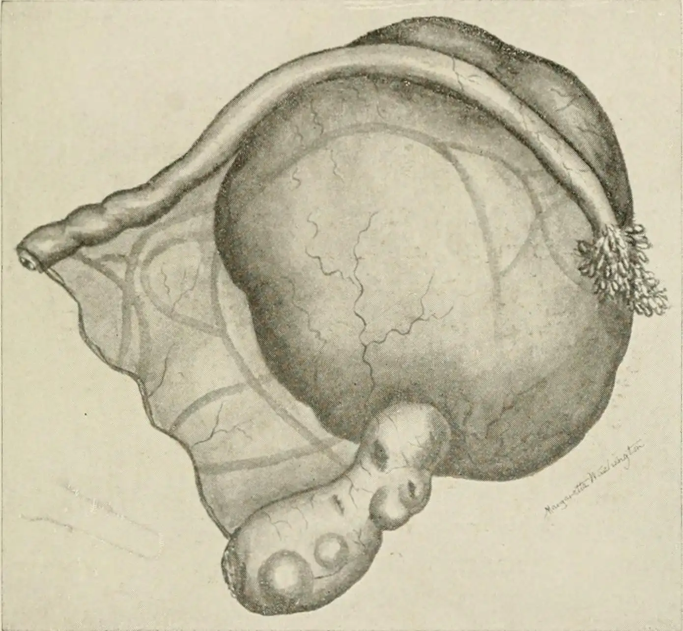 病理学标本的显微镜图像