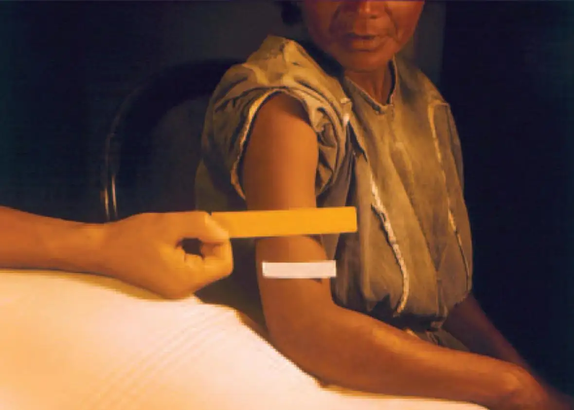 危地马拉梅毒实验的档案照片