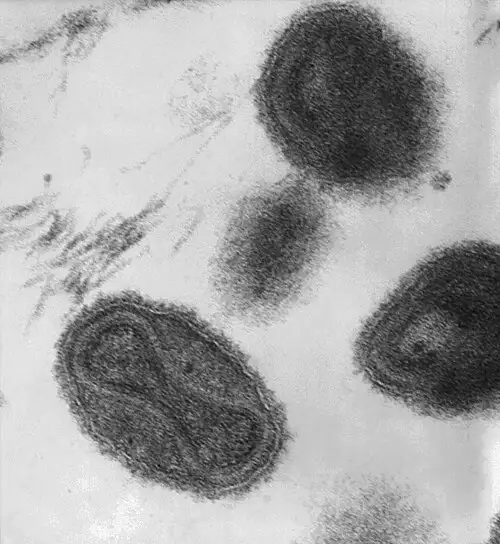 天花病毒电子显微镜图像