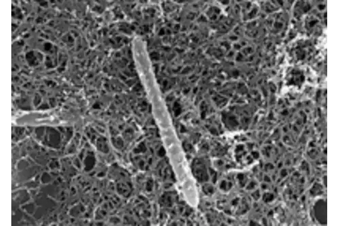 Desulforudis audaxviator细菌的显微镜图像，这种细菌能够独自支撑一个完整的地下生态系统