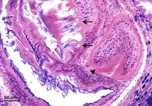 猪肉囊尾蚴组织学切片，显示透明的囊壁和内部结构