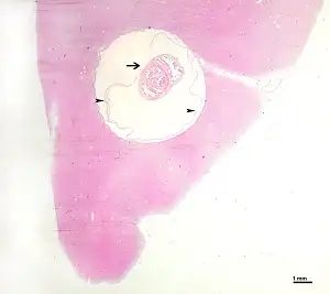 猪肉绦虫囊尾蚴的组织学切片，显示头节和螺旋状管道