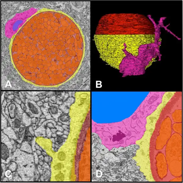 弓形虫组织囊在神经元中的电子显微镜图像