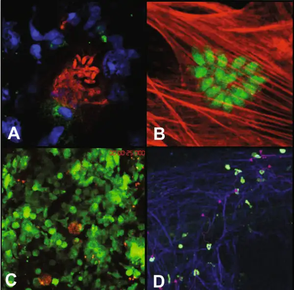 弓形虫感染细胞后的荧光显微镜图像