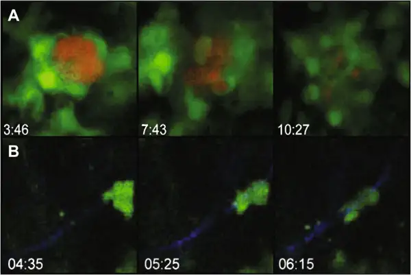 免疫细胞与弓形虫感染神经元的相互作用