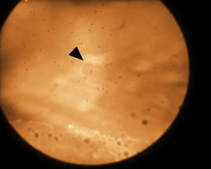 微丝蚴在血液涂片中的形态