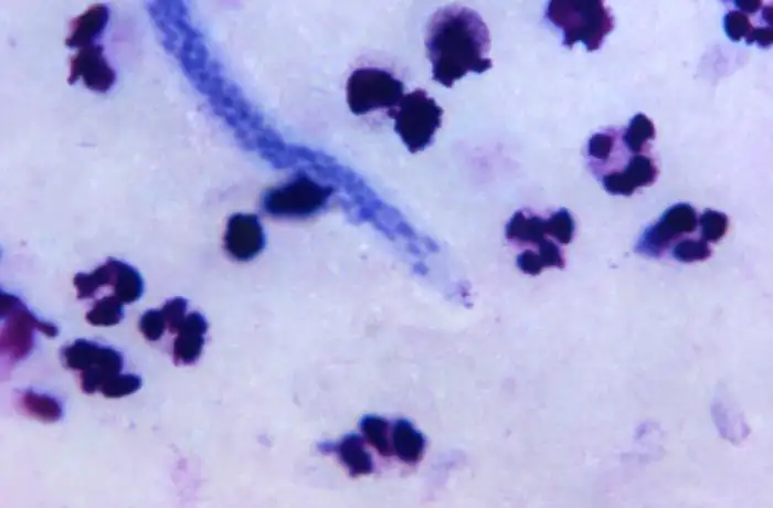 微丝蚴显微镜图像