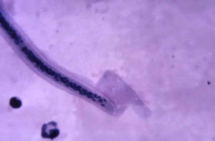 微丝蚴头部细节