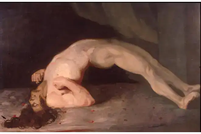 1809年查尔斯·贝尔绘制的一名破伤风患者的角弓反张姿态，展示背部肌肉强烈收缩形成的拱形姿势