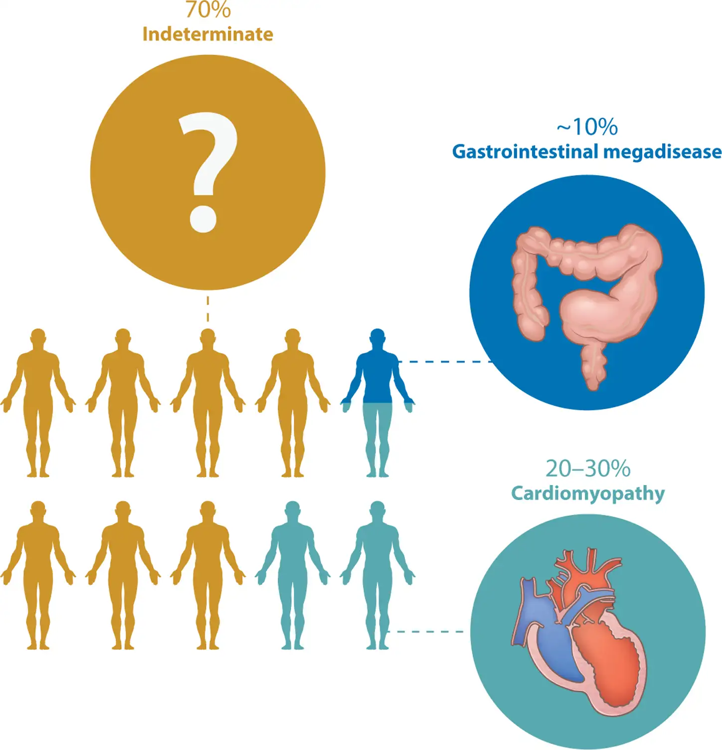 慢性恰加斯病的可能结局