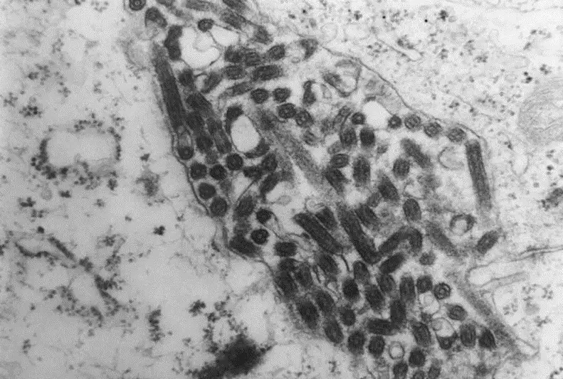 1975年马尔堡病毒电镜确认