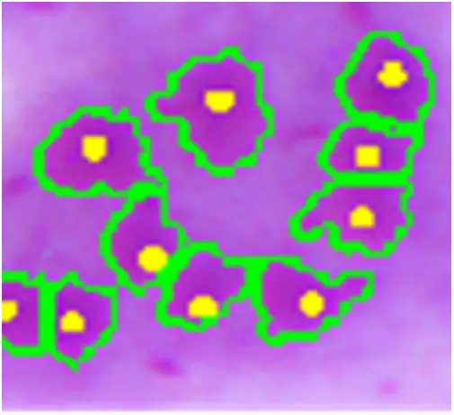 无鞭毛体的显微镜检测