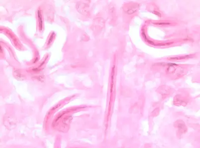 微丝蚴显微镜图像