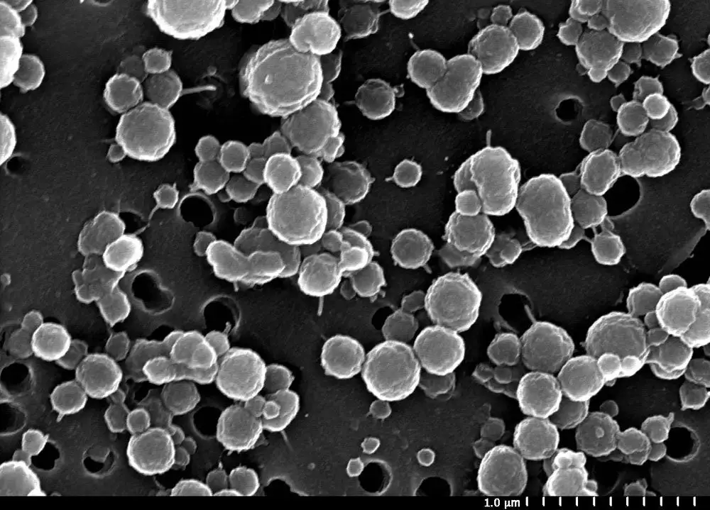 Lake Vida中发现的细菌