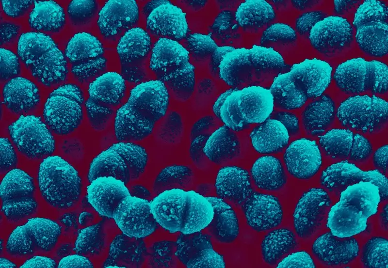 链球菌电子显微镜图像