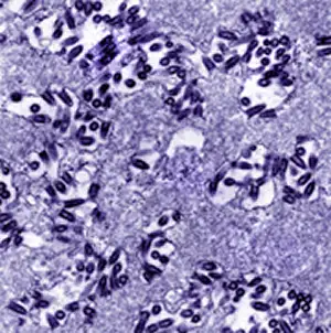 狂犬病毒感染仓鼠脑组织的电镜照片，显示大量子弹状病毒颗粒