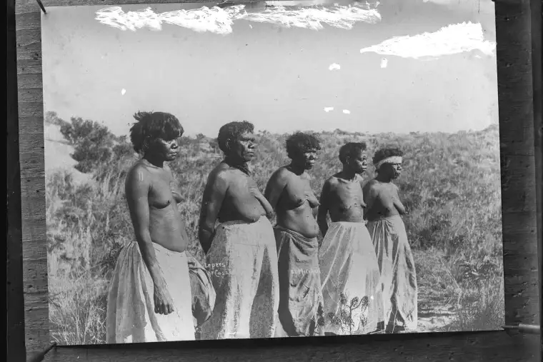 1911年科萨克麻风病隔离区附近的原住民