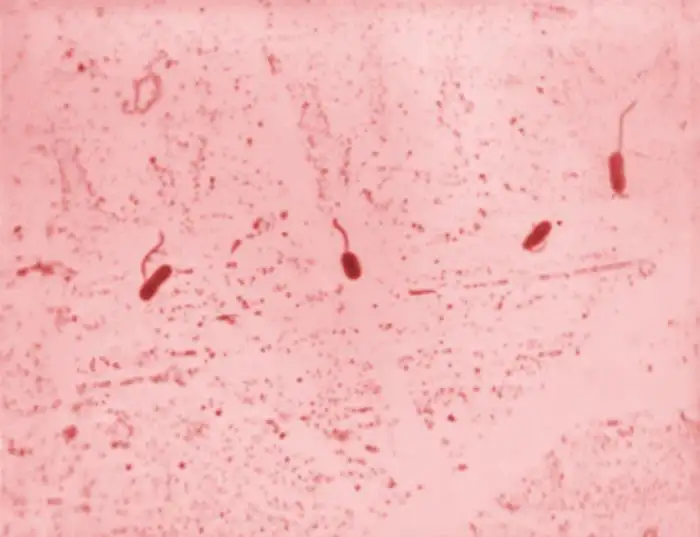 霍乱弧菌显微镜图像