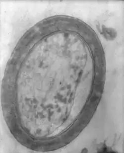 红雨细胞透射电镜照片