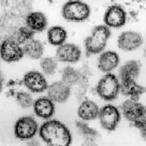 拉沙病毒电子显微镜图像