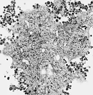 拉沙病毒薄切片电子显微镜图像