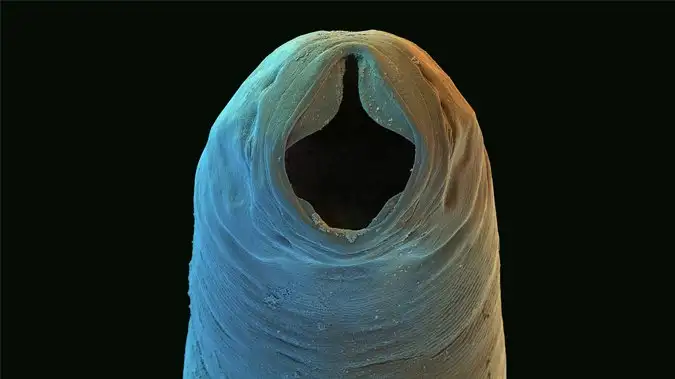 钩虫病的历史图片