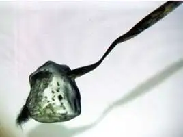 奥茨冰人携带的火绒菌