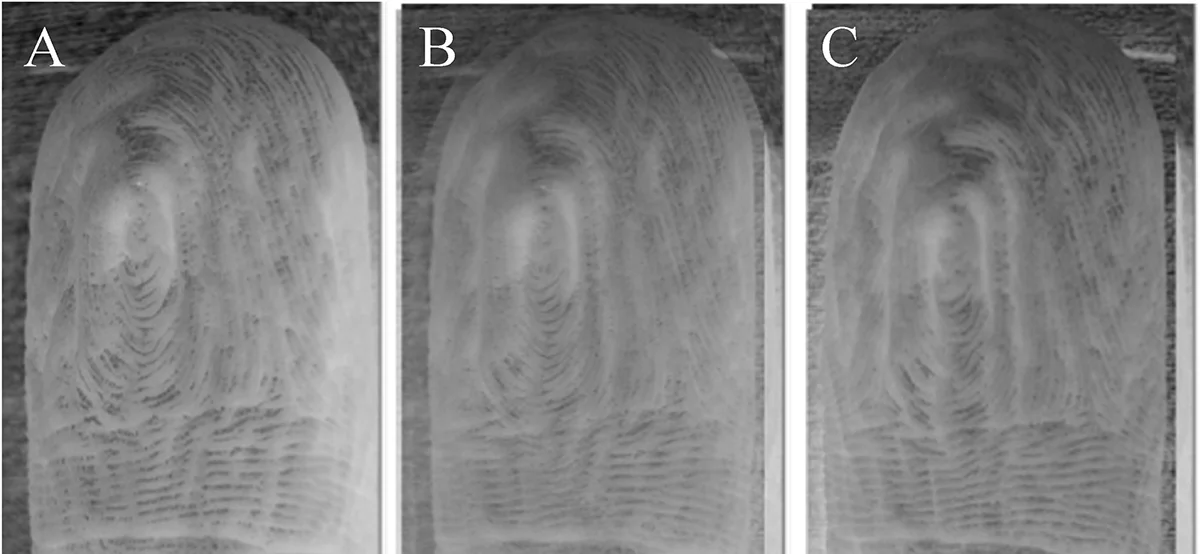 手指起皱图案一致性研究