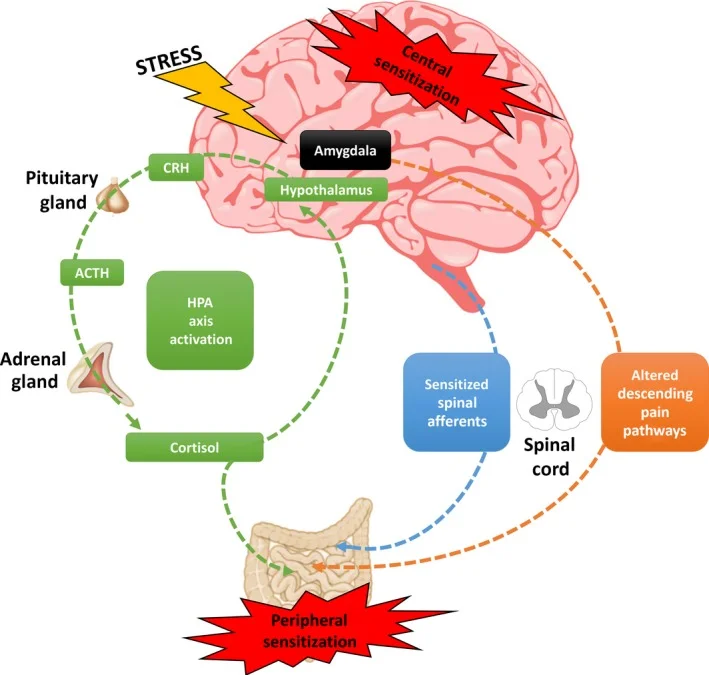 中枢敏化与内脏高敏感性机制