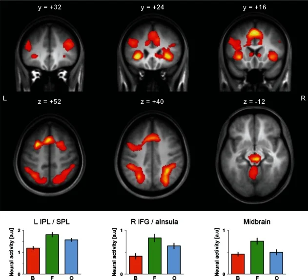 心流状态下的大脑活动模式：蓝色区域活动降低（DMN），红色区域活动增加