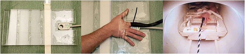 2015年MRI研究中的关节弹响图像